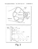 TECHNIQUES TO MONITOR AND TREND NERVE DAMAGE AND RECOVERY diagram and image