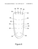 SIMPLIFIED SHOE CONSTRUCTION WITH MIDSOLE HAVING OVERMOLDED INSERT diagram and image