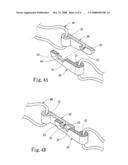 HAIR HOOP STRUCTURE diagram and image