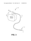 Connector for an implantable medical device diagram and image