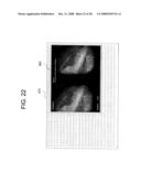 ENDOSCOPIC IMAGE VIEWING PROGRAM AND METHOD diagram and image