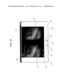 ENDOSCOPIC IMAGE VIEWING PROGRAM AND METHOD diagram and image