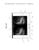 ENDOSCOPIC IMAGE VIEWING PROGRAM AND METHOD diagram and image