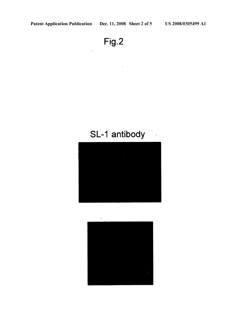Anti-Synoviolin Antibody - diagram, schematic, and image 03