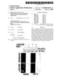 Modulation Of Cd4+ T Cell Responses By A Tick Saliva Protein, Salp15 And Polypeptides Derived Therefrom diagram and image