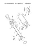 Endoscopic vessel harvesting system components diagram and image