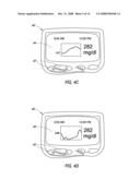 SYSTEM AND METHODS FOR PROCESSING ANALYTE SENSOR DATA diagram and image