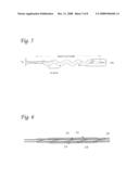 Spiral balloon catheter diagram and image