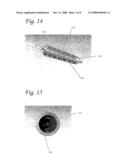 Spiral balloon catheter diagram and image