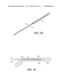 INTEGRATED MEDICAMENT DELIVERY DEVICE FOR USE WITH CONTINUOUS ANALYTE SENSOR diagram and image