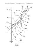 Guide Wire diagram and image