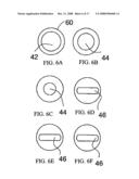 Guide Wire diagram and image