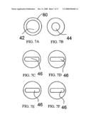 Guide Wire diagram and image