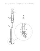 Inserter for a spinal implant diagram and image