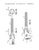 DEFLECTION ROD SYSTEM FOR SPINE IMPLANT WITH END CONNECTORS AND METHOD diagram and image