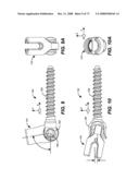 DEFLECTION ROD SYSTEM FOR A DYNAMIC STABILIZATION AND MOTION PRESERVATION SPINAL IMPLANTATION SYSTEM AND METHOD diagram and image