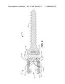 REVISION SYSTEM FOR A DYNAMIC STABILIZATION AND MOTION PRESERVATION SPINAL IMPLANTATION SYSTEM AND METHOD diagram and image