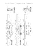 REVISION SYSTEM FOR A DYNAMIC STABILIZATION AND MOTION PRESERVATION SPINAL IMPLANTATION SYSTEM AND METHOD diagram and image