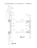 REVISION SYSTEM FOR A DYNAMIC STABILIZATION AND MOTION PRESERVATION SPINAL IMPLANTATION SYSTEM AND METHOD diagram and image