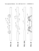 REVISION SYSTEM FOR A DYNAMIC STABILIZATION AND MOTION PRESERVATION SPINAL IMPLANTATION SYSTEM AND METHOD diagram and image