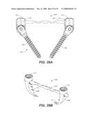 REVISION SYSTEM FOR A DYNAMIC STABILIZATION AND MOTION PRESERVATION SPINAL IMPLANTATION SYSTEM AND METHOD diagram and image