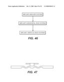 REVISION SYSTEM FOR A DYNAMIC STABILIZATION AND MOTION PRESERVATION SPINAL IMPLANTATION SYSTEM AND METHOD diagram and image