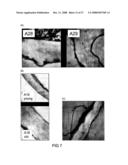 Polysaccharide Synthases diagram and image