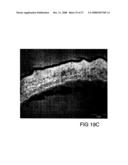 Polysaccharide Synthases diagram and image