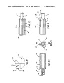 CABLE LENGTH ADJUSTMENT MECHANISM diagram and image