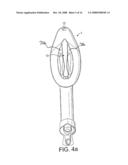 Laryngeal Mask Airway Device diagram and image