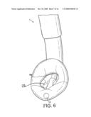 Laryngeal Mask Airway Device diagram and image