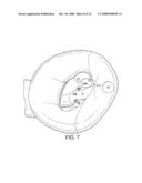 Laryngeal Mask Airway Device diagram and image