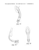 Laryngeal Mask Airway Device diagram and image