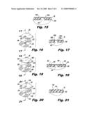 Interlocking buttress material retention system diagram and image