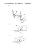 Printer diagram and image