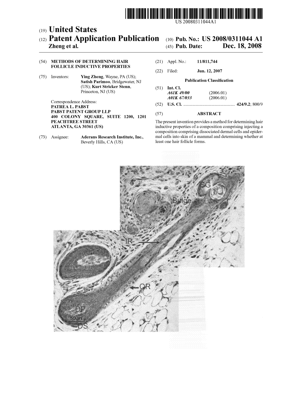 Methods of determining hair follicle inductive properties - diagram, schematic, and image 01