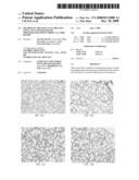 Method of Treating Lung Diseases Using Cells Separated Or Proliferated From Umbilical Cord Blood diagram and image