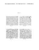 Method of Treating Lung Diseases Using Cells Separated Or Proliferated From Umbilical Cord Blood diagram and image