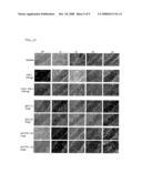 Process for the Determination of Inflammatory Process and Pharmaceutical Compositions for the Treatment Thereof diagram and image