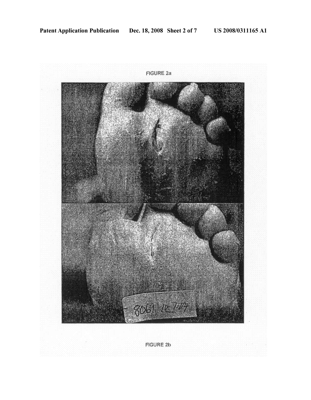 Copper Containing Materials for Treating Wounds, Burns and Other Skin Conditions - diagram, schematic, and image 03