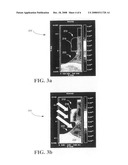 Short channel effect of MOS devices by retrograde well engineering using tilted dopant implantation into recessed source/drain regions diagram and image