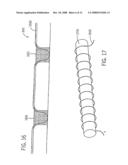 Method and Apparatus for Making Bags diagram and image