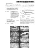 MUTATED AQP, METHOD FOR DETECTING CANCER USING THE SAME, DNA CHIP HAVING OLIGONUCLEOTIDES OF SAID MUTATED AQP SEQUENCE diagram and image