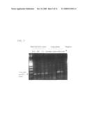 MUTATED AQP, METHOD FOR DETECTING CANCER USING THE SAME, DNA CHIP HAVING OLIGONUCLEOTIDES OF SAID MUTATED AQP SEQUENCE diagram and image