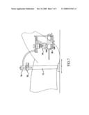 Mechanical Manipulator for Hifu Transducers diagram and image