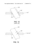 EXPANDABLE DIALYSIS APPARATUS AND METHOD diagram and image