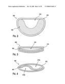 FLEXIBLE MEDICAL DEVICE CONDUIT diagram and image