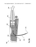 FLEXIBLE MEDICAL DEVICE CONDUIT diagram and image