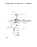 TRANSCECAL ILEOSTOMY SET diagram and image