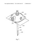 Medical Apparatus and Method of Use Thereof diagram and image